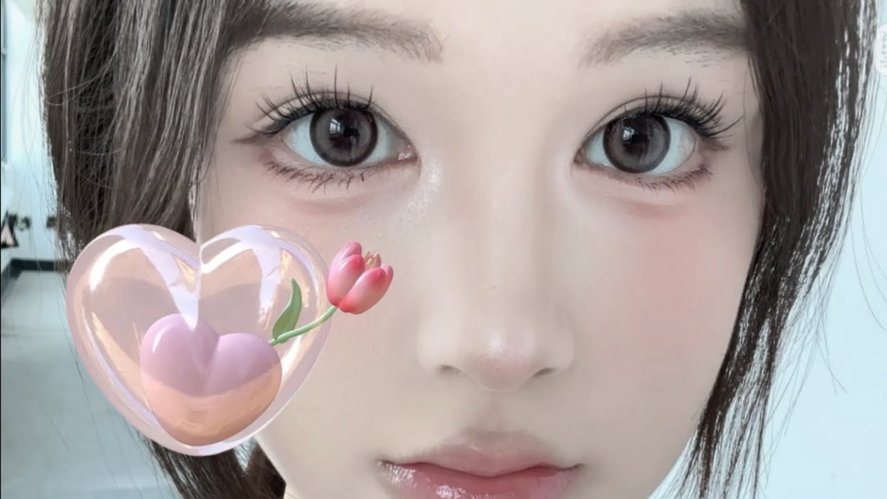 Canth0plasty + double eyelid correction; Wide Hypnotic Symmetrical Flawless Eye Shape.