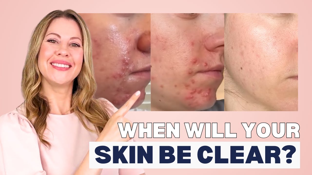 12 Weeks to Clear Skin: How to Make Science Work for You