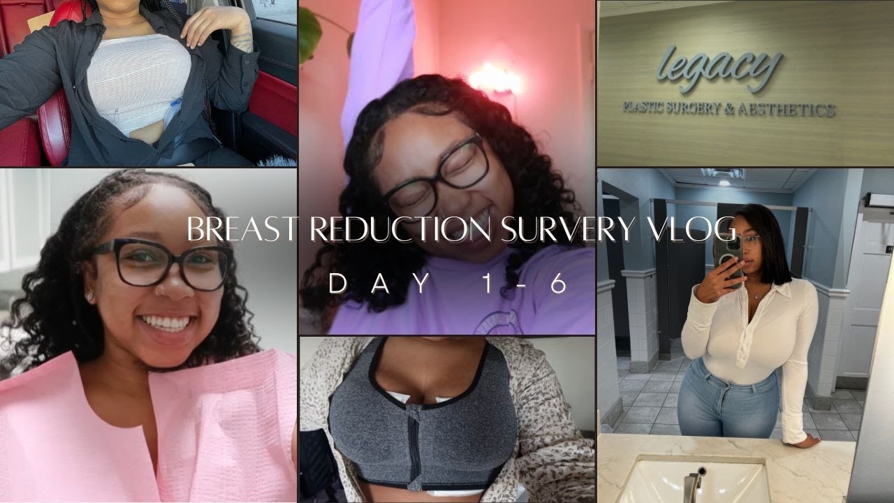 Breast reduction surgery vlog 2024| SURGERY DAY+ 6 days post op + first shower! | ep. 14