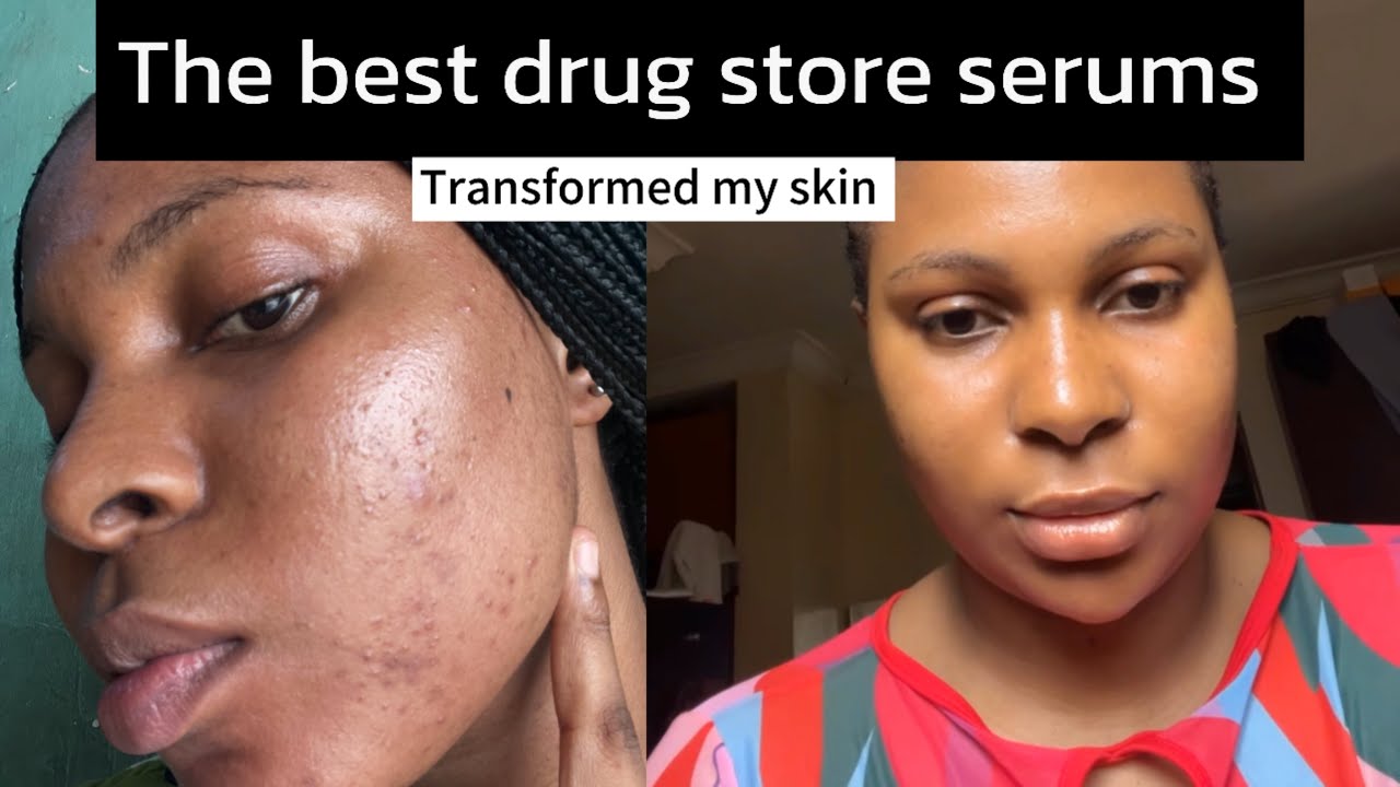 The Best face serums for glowing skin