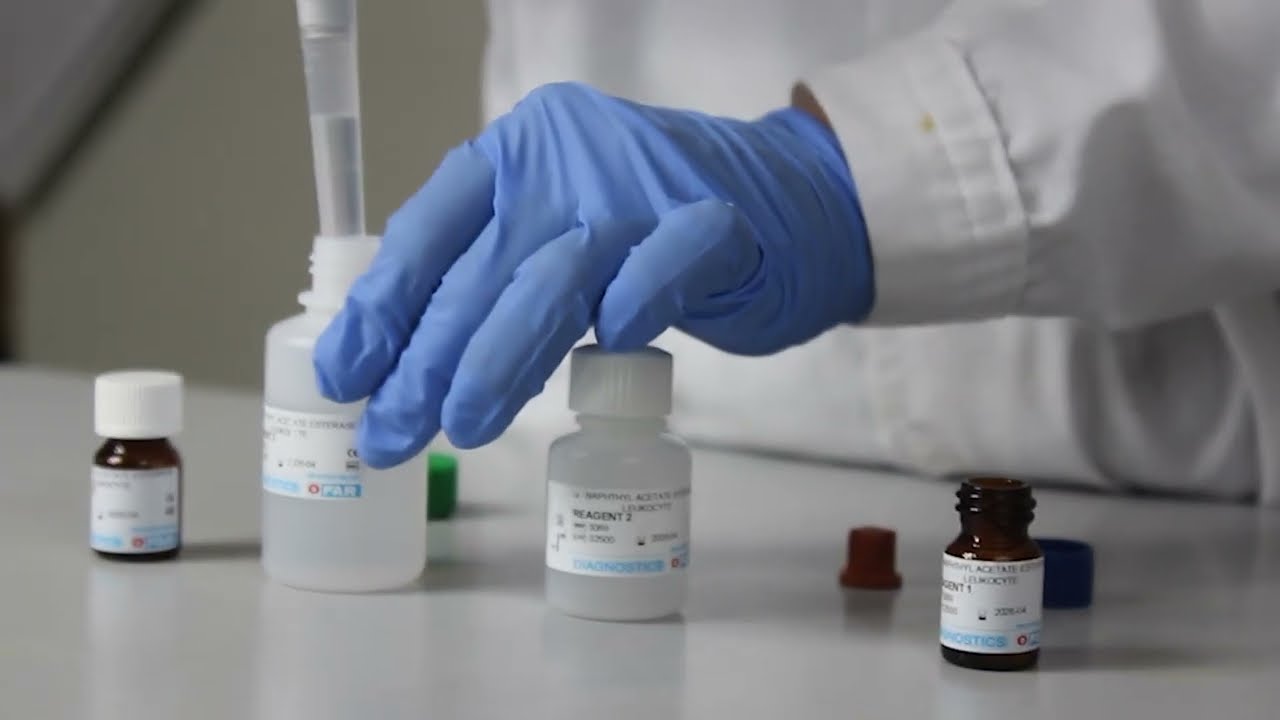 &alpha;-NAPHTHYL ACETATE ESTERASE LEUKOCYTE [USE TUTORIAL]