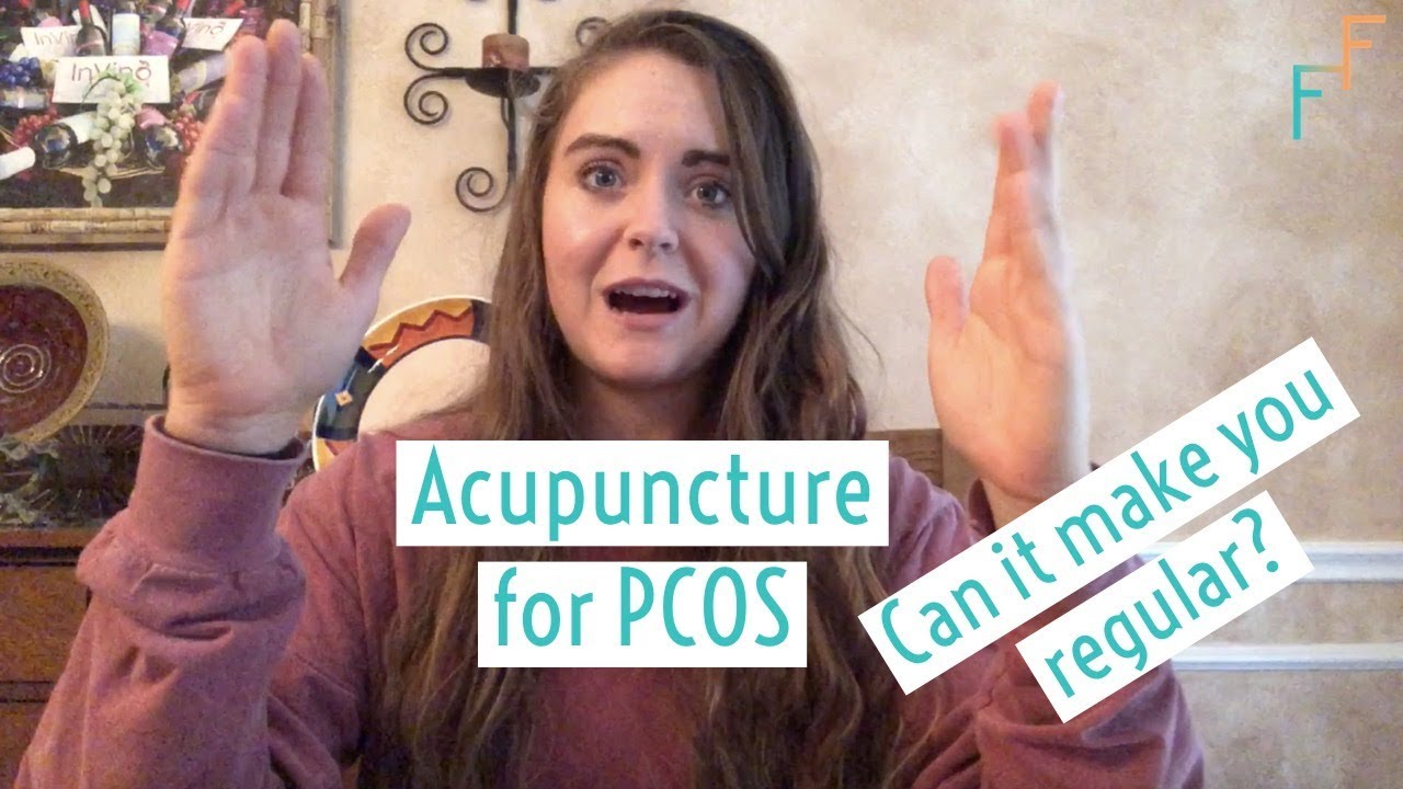 Acupuncture for PCOS: Regulating my Cycle Naturally