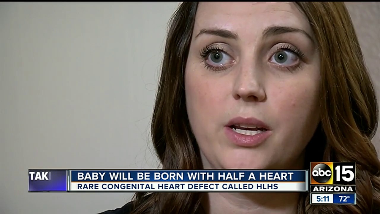 Family preparing for child to be born with heart defect