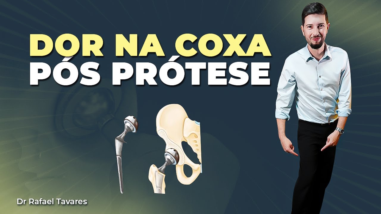 Por que tenho dor na COXA ap&oacute;s a pr&oacute;tese do quadril? | Dr Rafael Tavares - Quadril