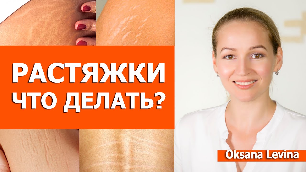 Растяжки на коже, как убрать. Рубцы и стрии, что делать. Лучшие методы борьбы с растяжками