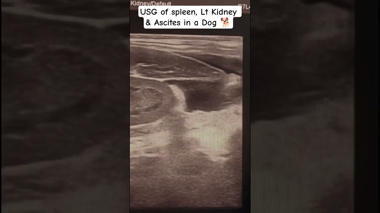 #USG of spleen, omentum, kidney and Peritoneal fluid (ascites) and UB in a dog