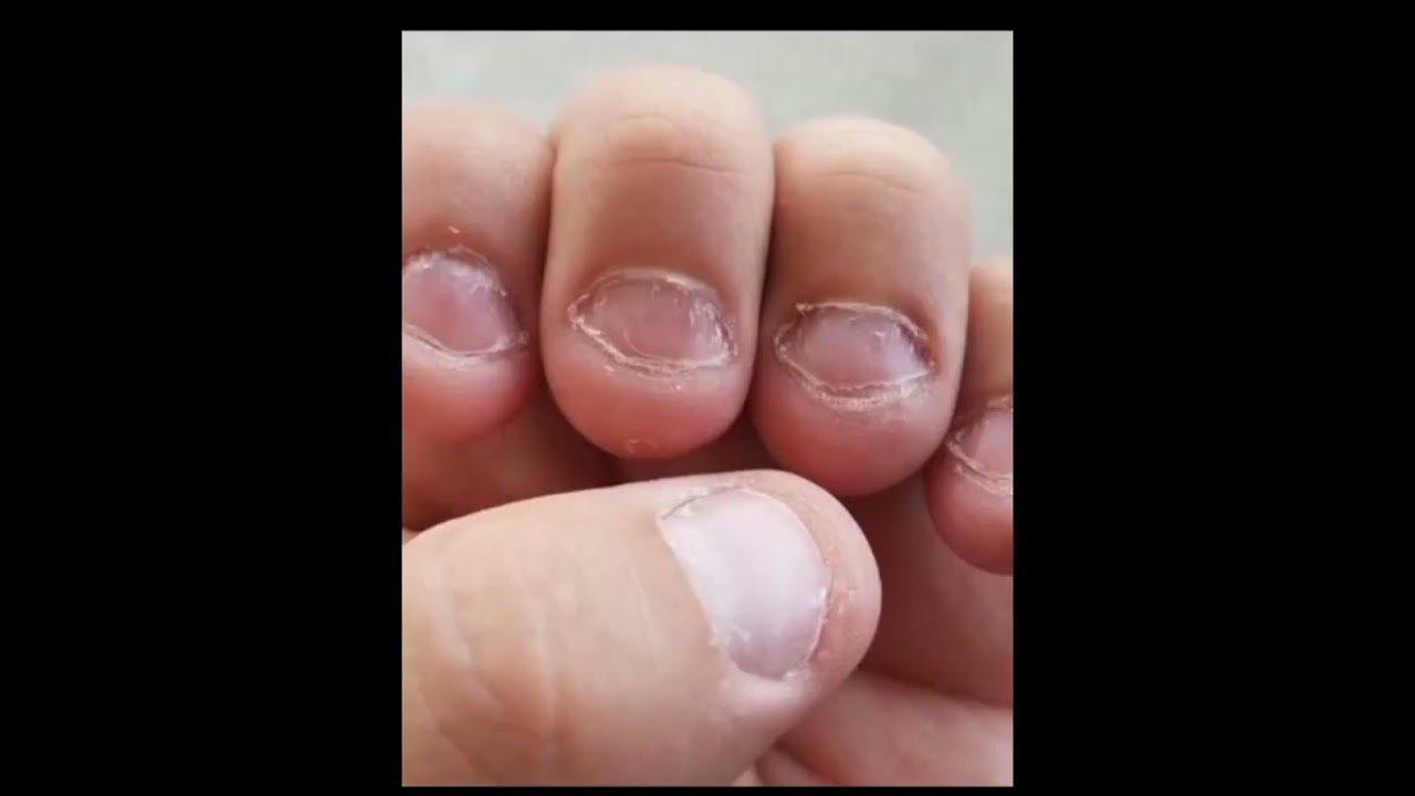 como fazer a unha crescer r&aacute;pido   💅🏼