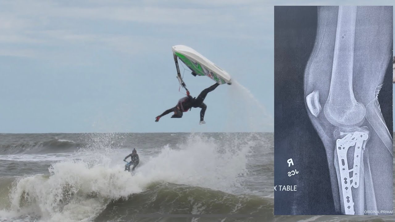 Jet Ski Freeride - Vlog 003 - I broke my leg 4K