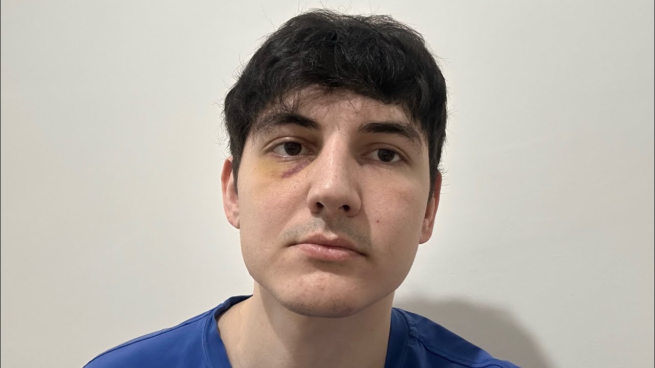 Сублимация страха в гнев