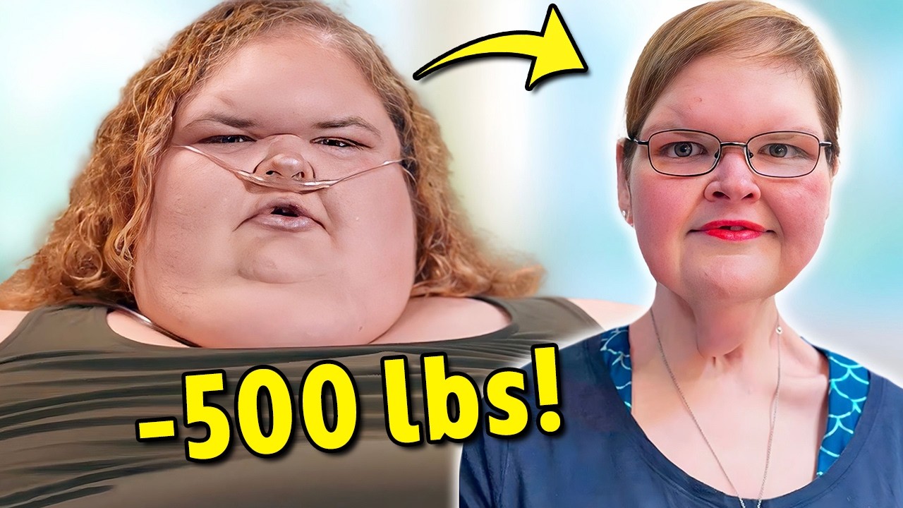 Doctor DENIES Tammy's Skin Removal Surgery AGAIN | 1000-lb Sisters & Best Friends RECAP