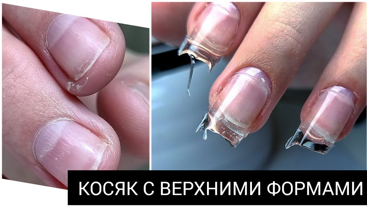 КОСЯК в наращивании((