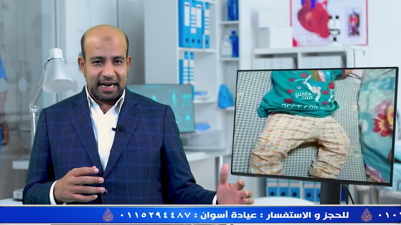 Signs of Infantile Spasms