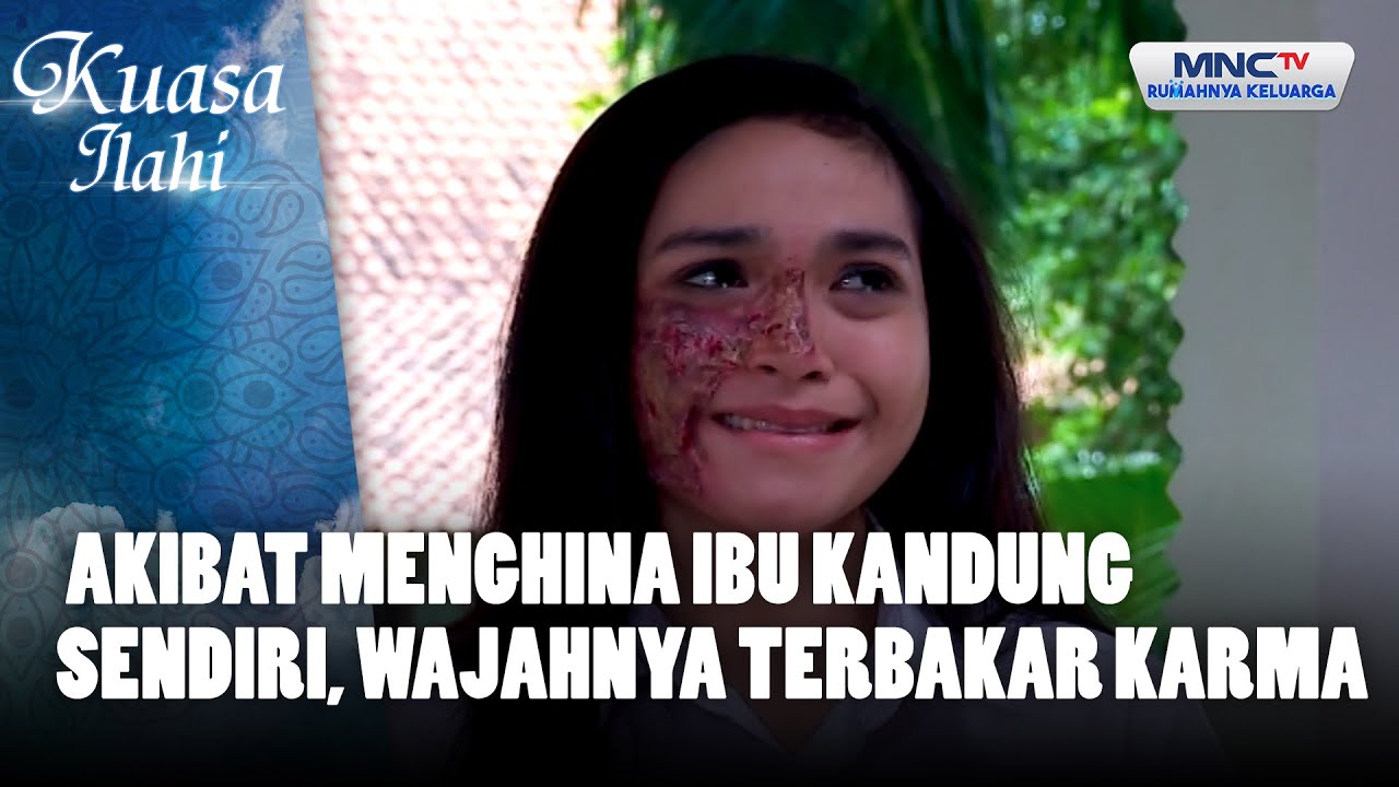 Akibat Menghina Ibu Kandung Sendiri, Wajahnya Terbakar Karma | KUASA ILAHI