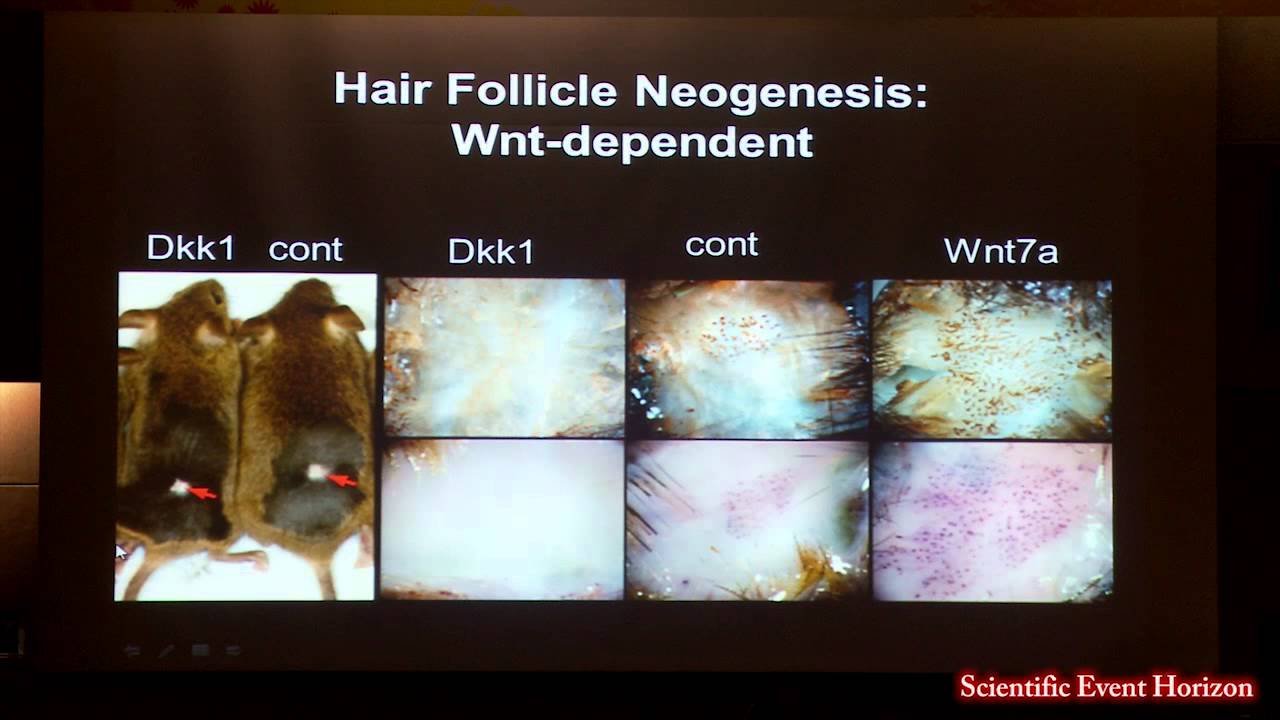 Dr George Cotsarelis: Hair Follicle Stem Cells & Skin Regeneration