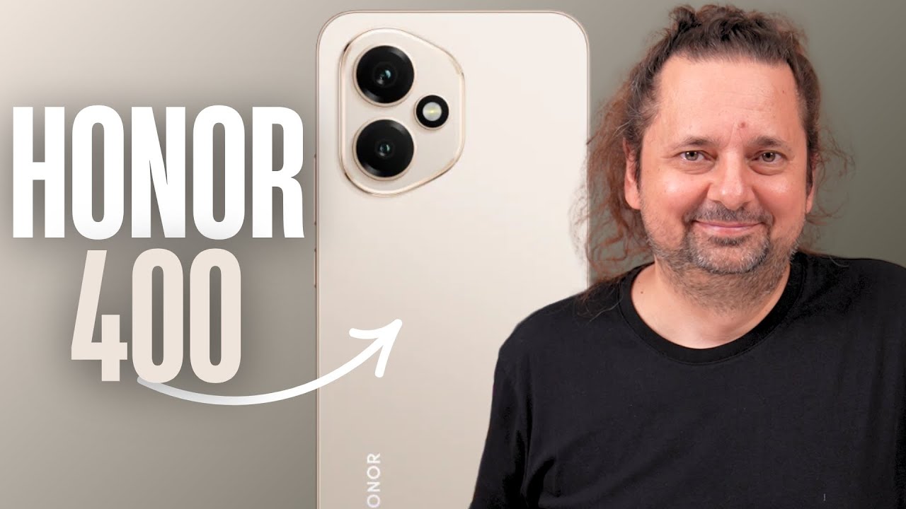 HONOR 400 Deneyimi | 