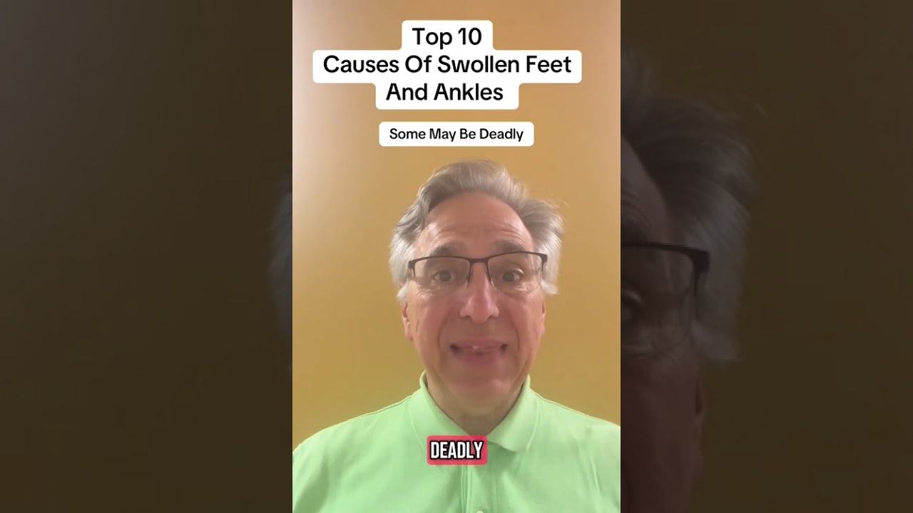 Top 10 Causes of swollen feet and ankles. Some can be deadly. 