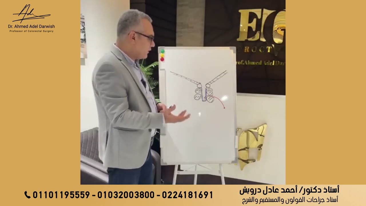 اتعرف على خريطة علاج الناسور الشرجي مع الأستاذ الدكتور أحمد عادل درويش