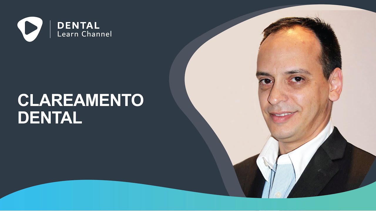 CLAREAMENTO DENTAL