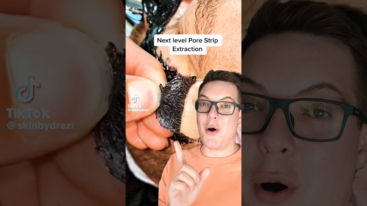 NEXT LEVEL PORE STRIP REMOVAL - So Many Blackheads #shorts