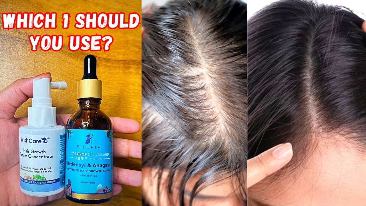 Pilgrim Vs Wishcare Hair Growth Serum | Pilgrim hair growth serum | Wishcare hair growth serum