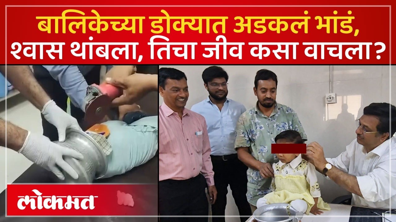 Jalgaon News : बालिकेच्या डोक्यात अडकलेलं भांडं कसं काढलं? PR2