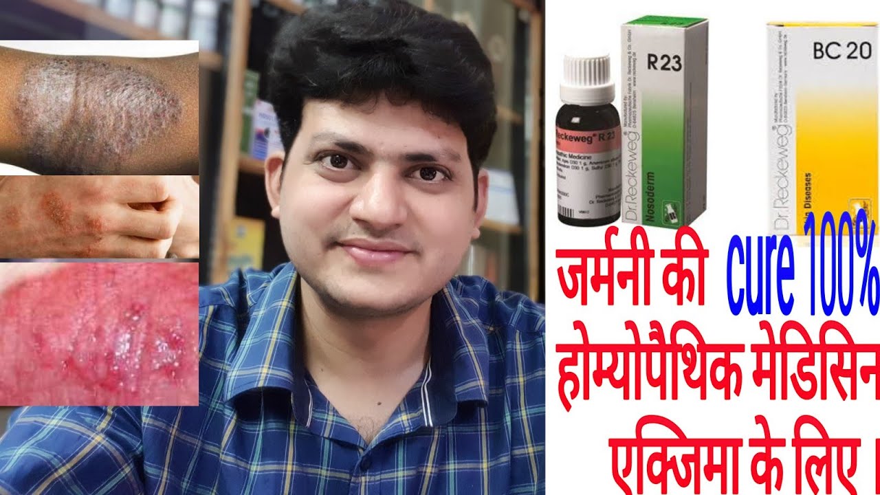 German Homeopathic medicine for Eczema ? Explain !