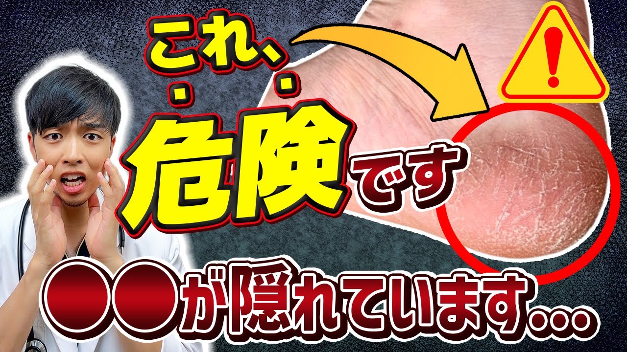 【要注意】踵のガサガサ、削らないで下さい。【内臓からのSOS】現役医師が伝えたい足でわかる病気の兆候【糖尿病/動脈硬化/水虫】