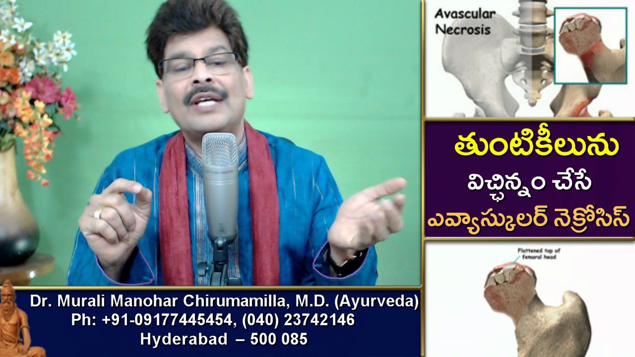 Avascular Necrosis and Ayurvedic Treatment in Telugu by Dr. Murali Manohar Chirumamilla, M.D..
