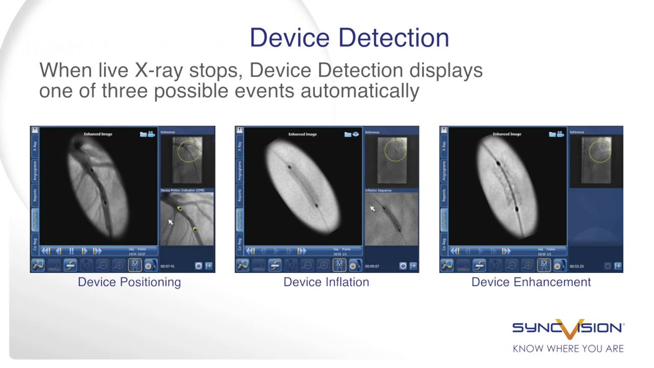 SyncVision Precision Guidance