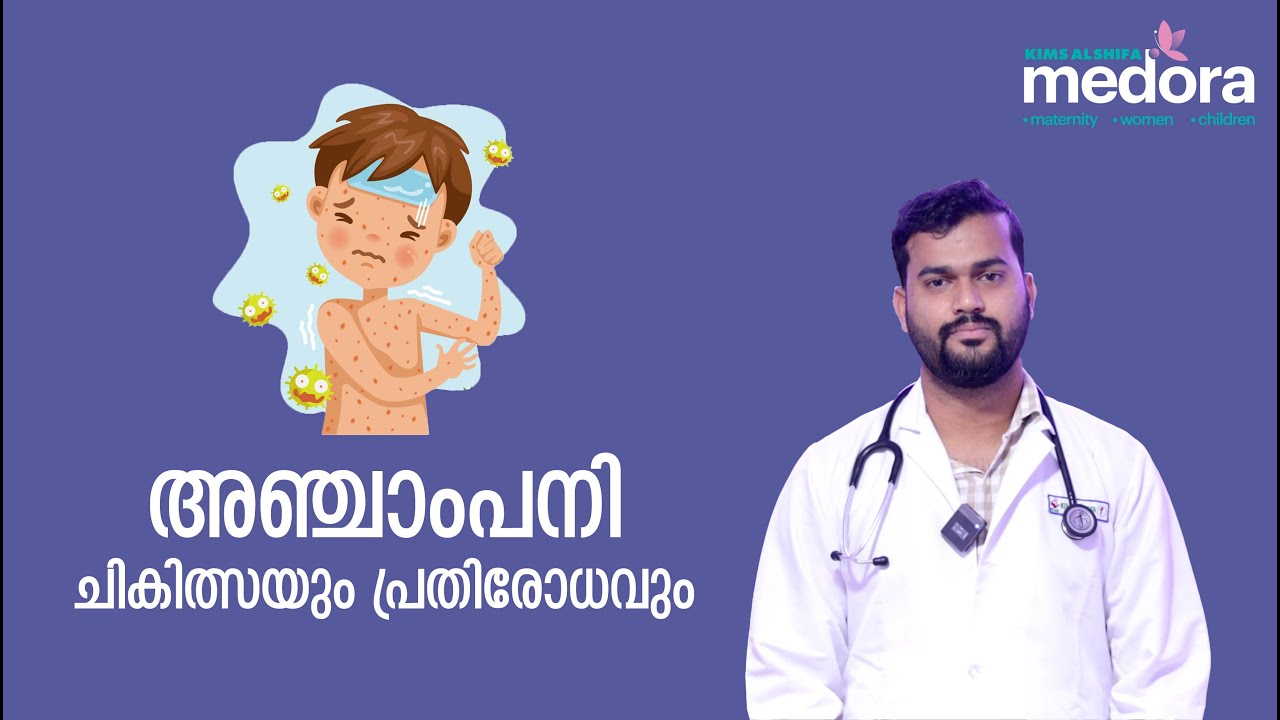 അഞ്ചാം പനി - ചികിത്സയും പ്രതിരോധവും | Measles | KIMS Alshifa Hospital