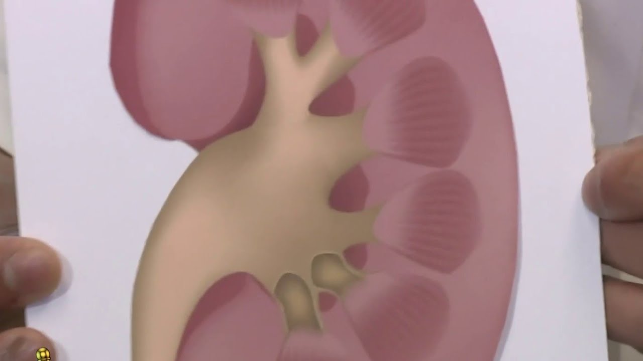 Young mother's kidney cancer diagnosis