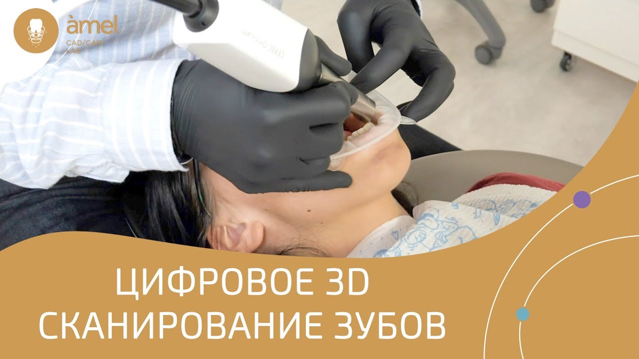 Зачем стоматологу интраоральный сканер зубов | CAD/CAM технологии | Bauers Dental Store