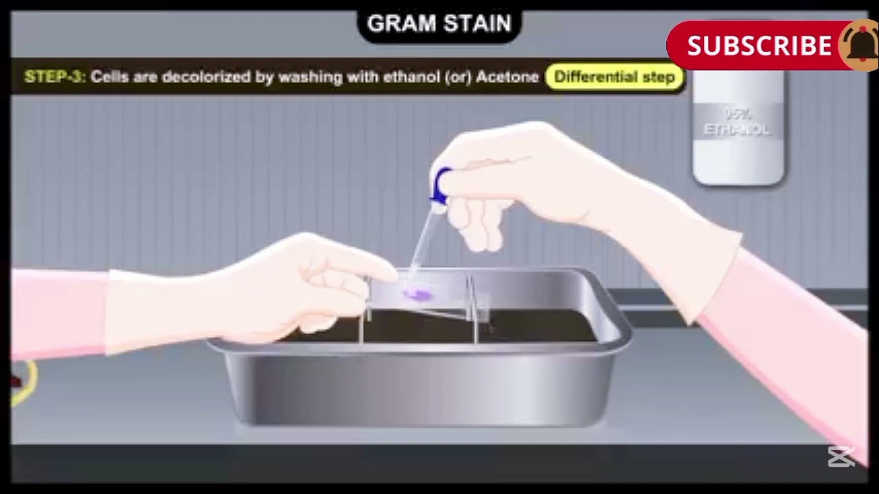 Gram Staining in urdu/ Hindi 
