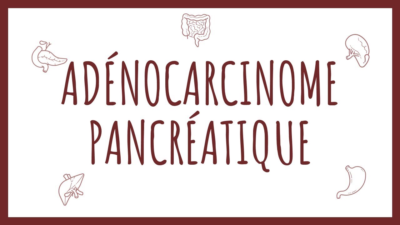 Sémiologie Pancréas - Adénocarcinome