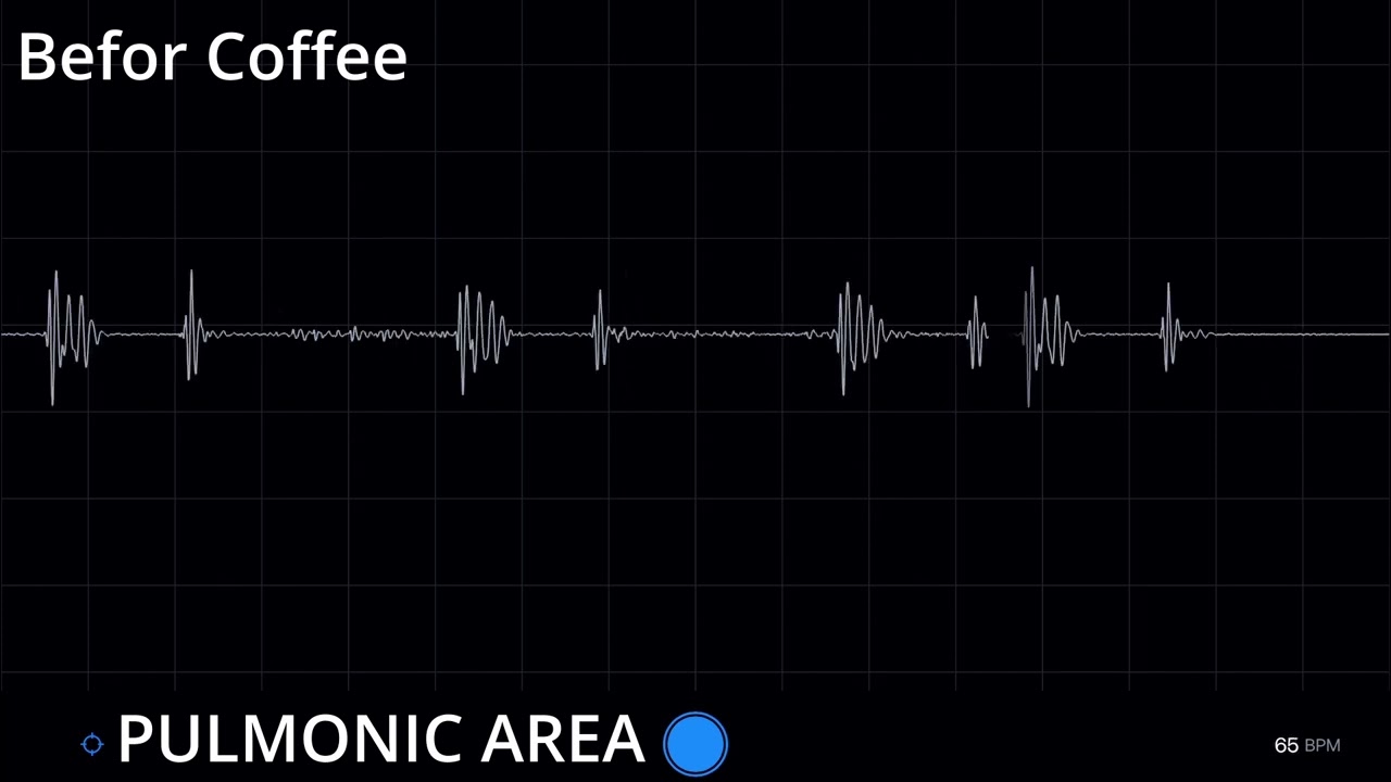 Heartbeat Befor and After Coffee ☕🩺❤️ [Male Heartbeat]