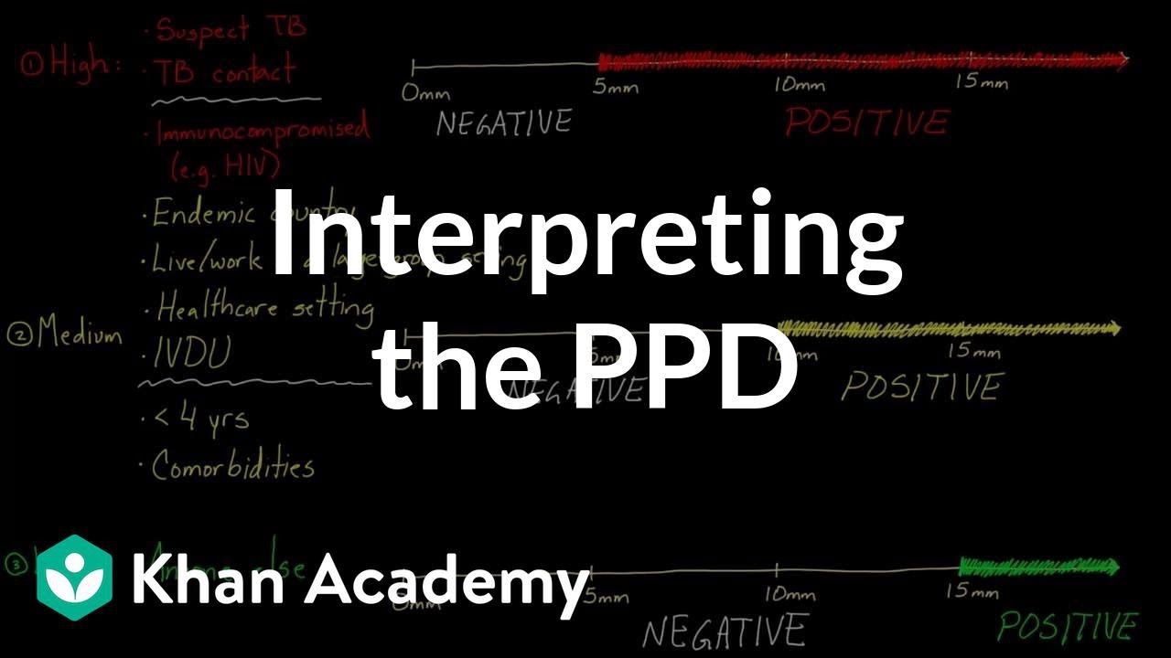 Interpreting the PPD | Infectious diseases | NCLEX-RN | Khan Academy