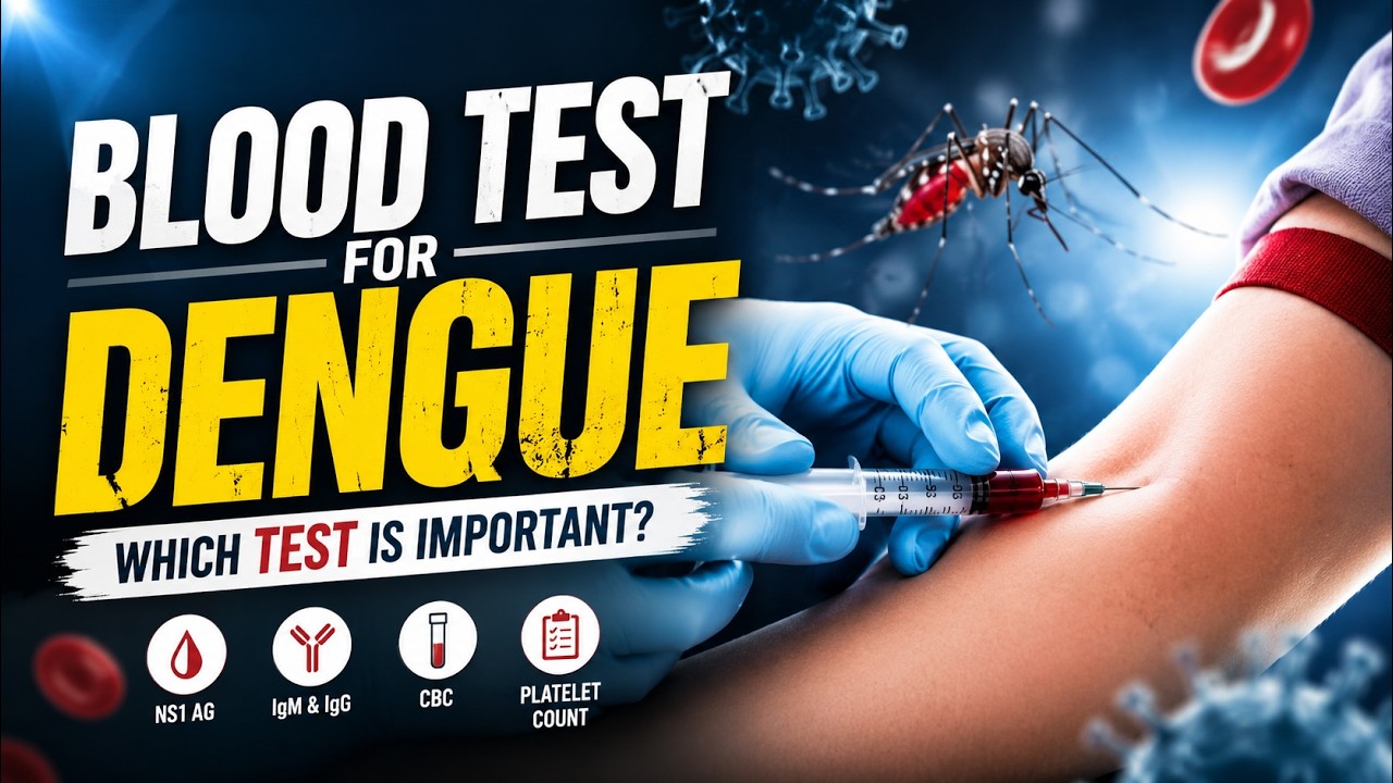 Blood test for Dengue fever II Blood Test | Dengue Infection II  Dengue Fever