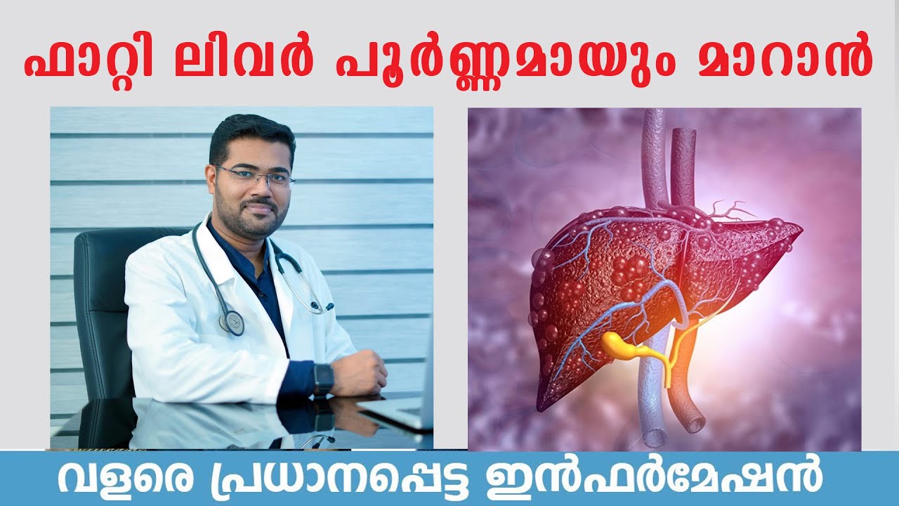ഫാറ്റി ലിവര്‍ വരാതിരിക്കുവാനും വന്നാല്‍ പൂര്‍ണ്ണമായും മാറാനും  / Dr Manoj Johnson