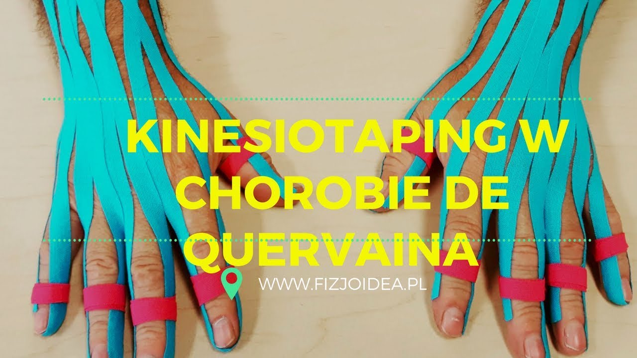 Choroba de Quervaina- KINESIOTAPING