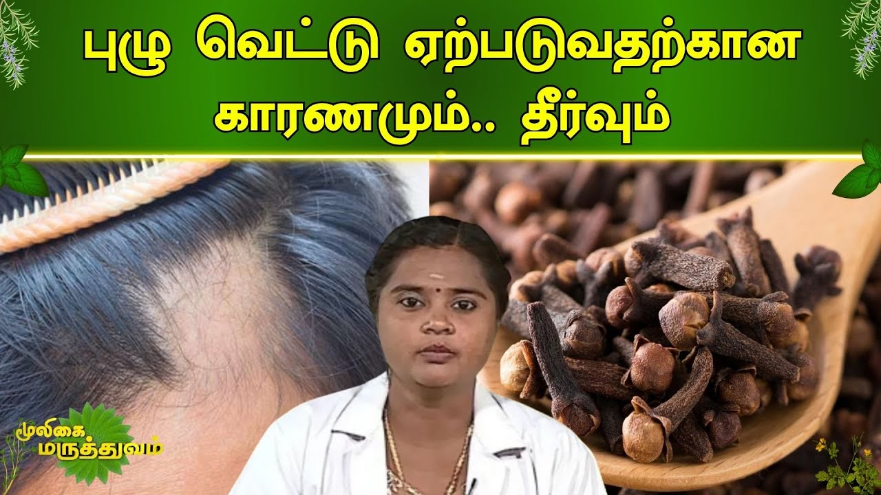 புழு வெட்டு ஏற்படுவதற்கான காரணமும்.. தீர்வும் #mooligaimaruthuvam | Vendhar TV