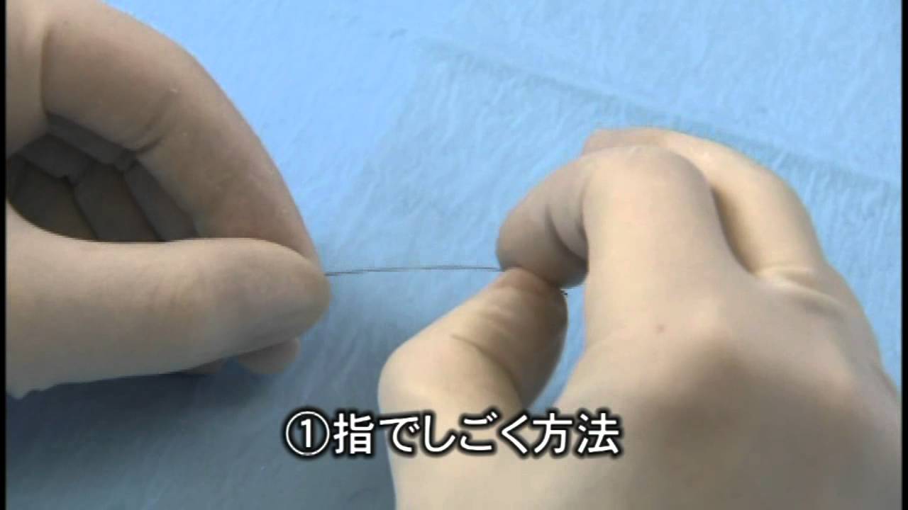 Angioplasty technique: pre-shaping