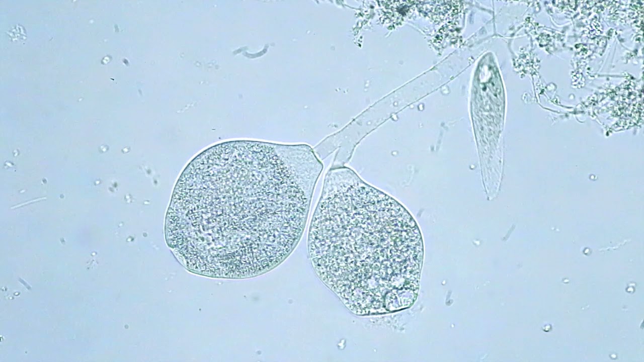 Kr&oacute;lestwo epistylis