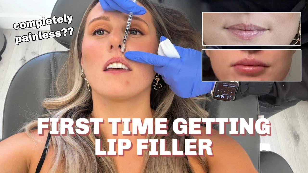 LIP FILLER FOR THE FIRST TIME | the entire process (half syringe + no pain)