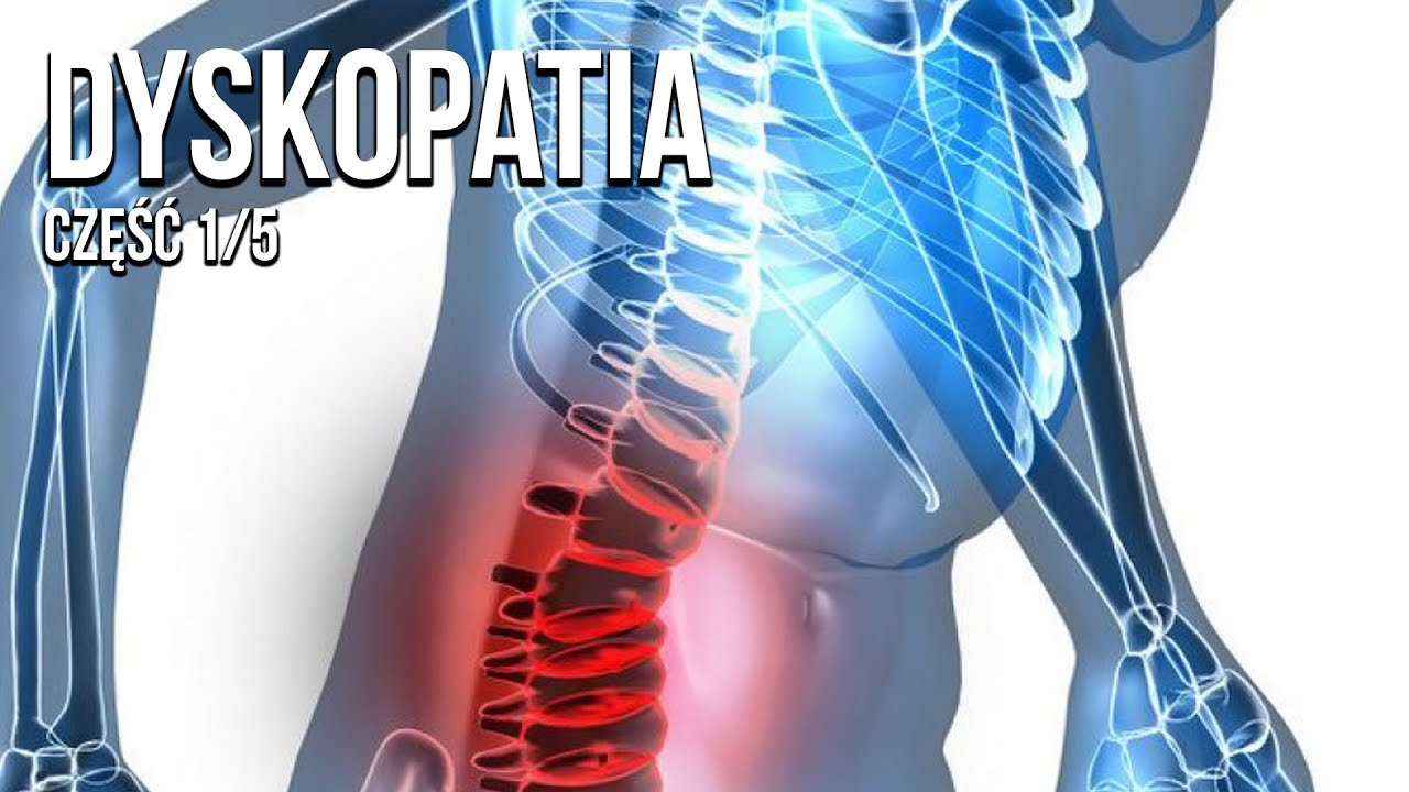 POSTĘPOWANIE U KLIENTA Z DYSKOPATIĄ 1/5