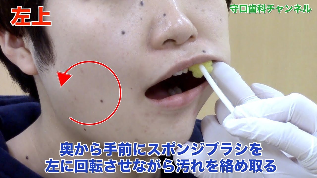 【盛岡市 歯医者】上手に回転させて！スポンジブラシ粘膜清掃術_守口歯科チャンネル064（口腔ケアチャンネル）