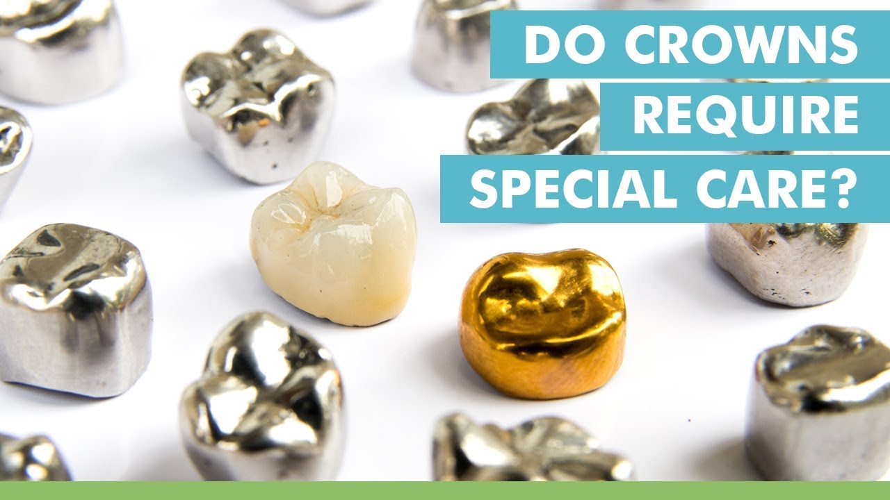 Do Crowns Require Special Care?