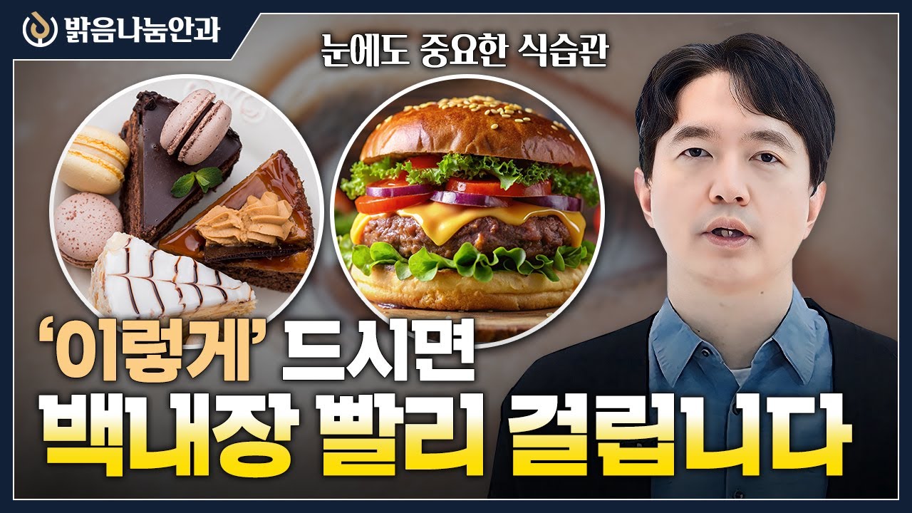 '이것' 있으면 백내장에 쉽게 걸린다고?