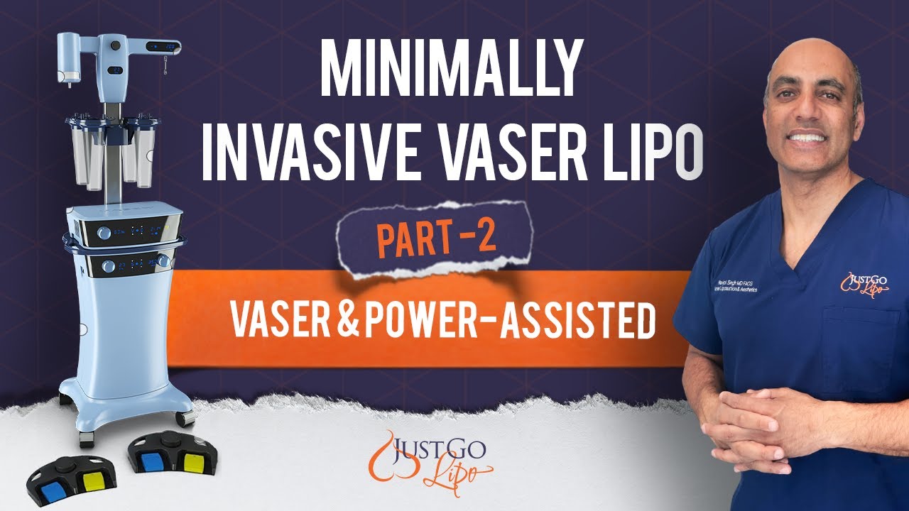 Minimally Invasive Vaser Lipo Part 2: Vaser & Power-Assisted Lipo