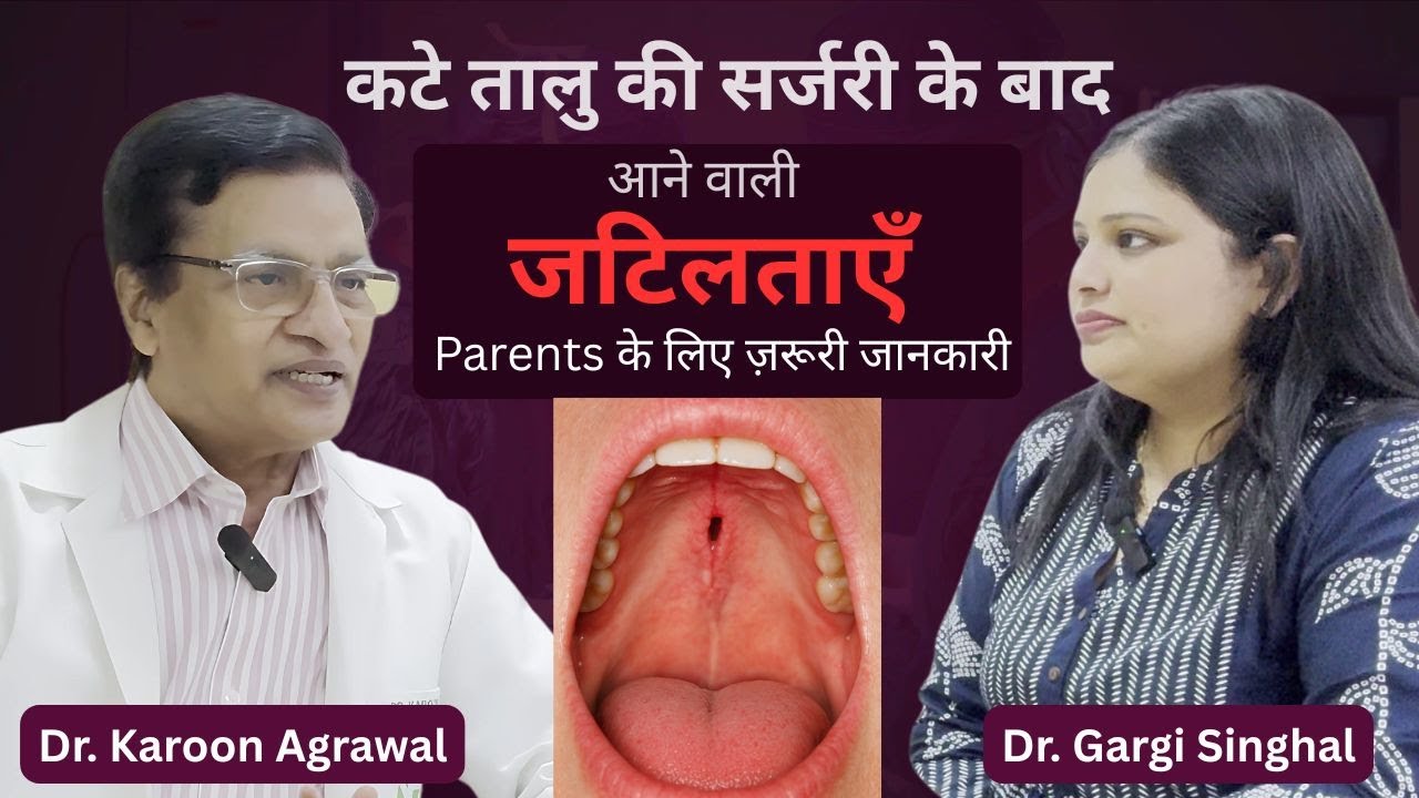 कटे तालु की सर्जरी (Cleft Palate Surgery) के बाद आने वाली जटिलताएँ Complications | Dr Karoon Podcast