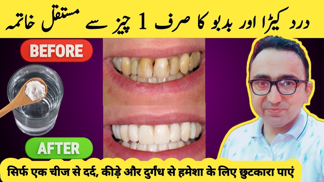 Fix Dental Cavity, Toothache & Bad Breath Naturally With Just 1 Ingredient!
